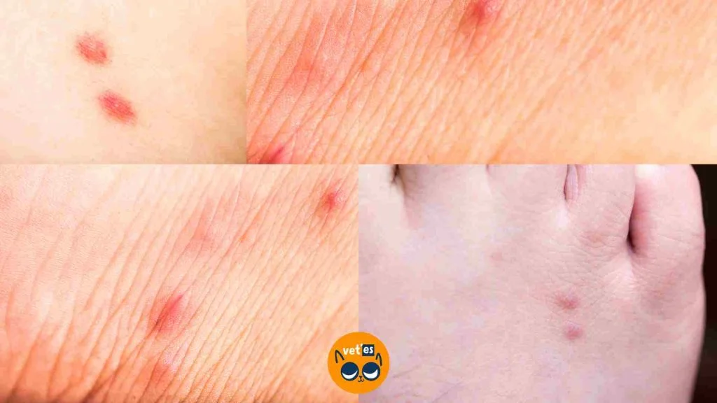 Kedi Piresi İnsana Geçer Mi? 5 kedi piresinin insan üzerindeki ısırıkları